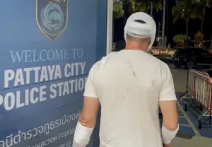 Russian Tourist Hospitalised After Robbery and Assault by Three Men in Pattaya
